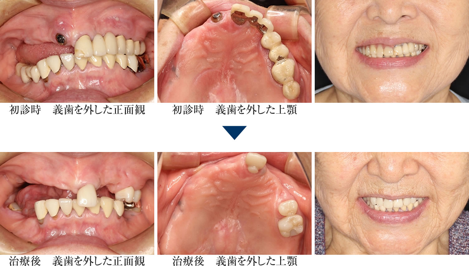 治療前後の比較