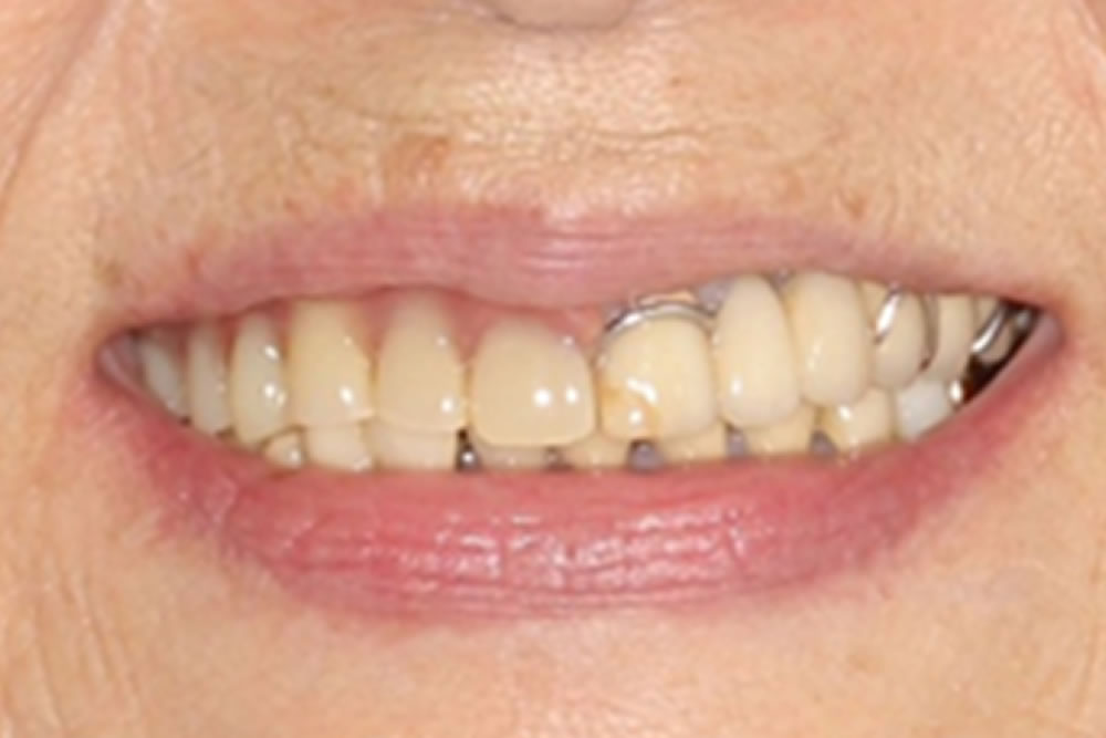 初診時 口元の見え方