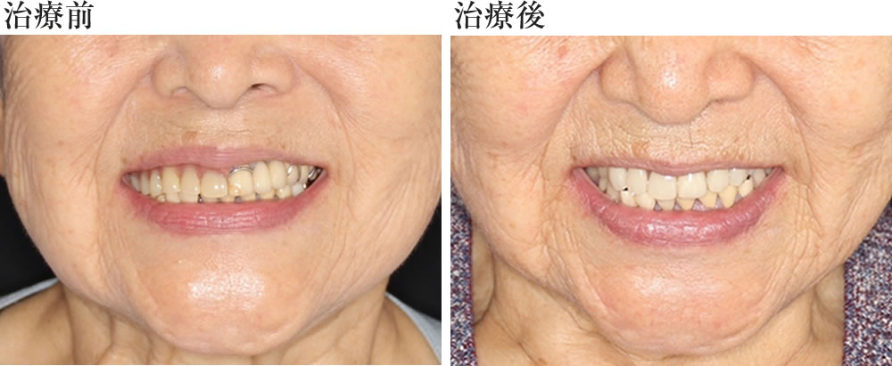 治療前後の状態